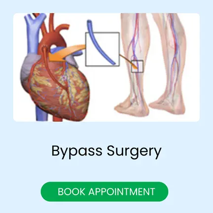 Bypass Surgery