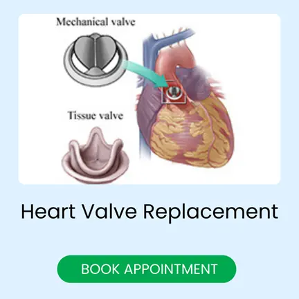 heart valve replacement in india