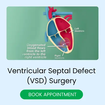 ventricular Septal defect